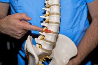 Pourquoi le dos fait-il mal dans le bas du dos et que faire