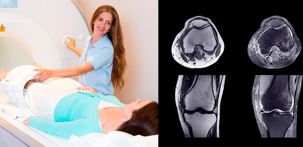 diagnostic de l'articulation du genou