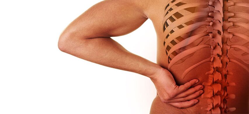 symptômes de l'ostéochondrose lombaire